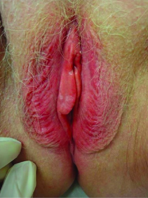 Седые вагины фото