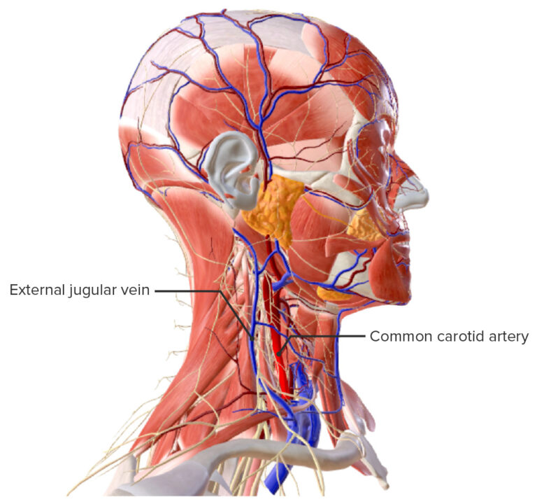 Sistema Arterial Carot Deo Anatom A Concise Medical Knowledge