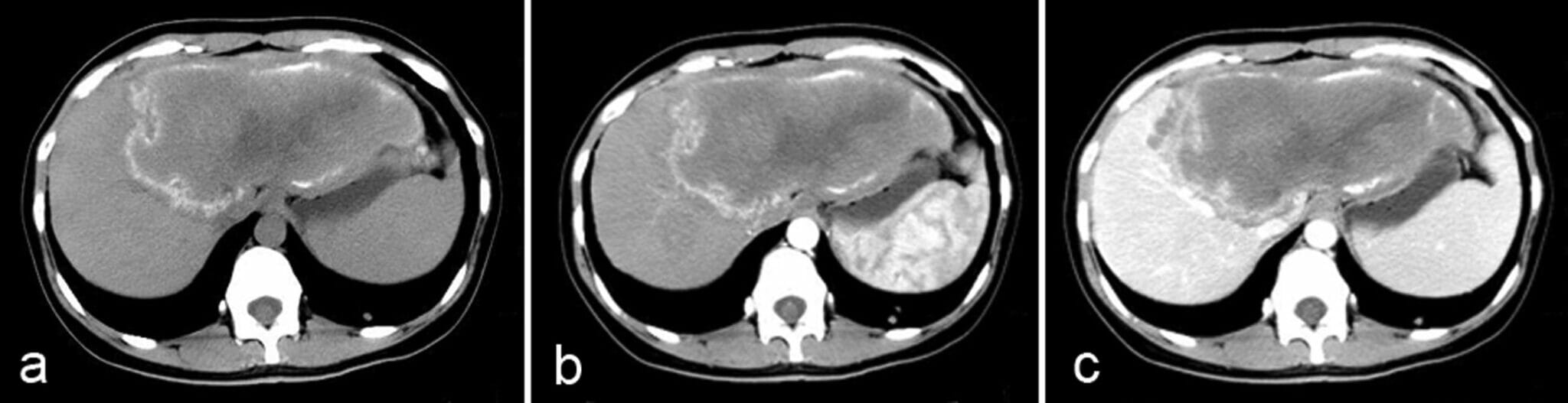 Computed Tomography Ct Concise Medical Knowledge