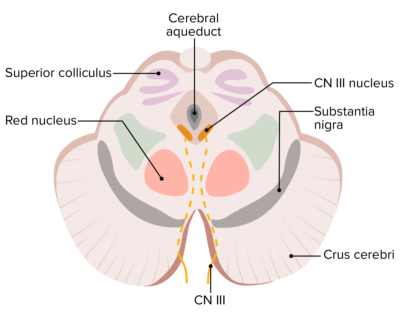 Tallo Cerebral Anatom A Concise Medical Knowledge