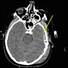 Computed Tomography Ct Concise Medical Knowledge