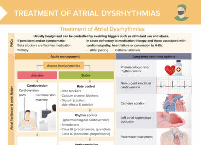 Dysrhythmias Free Cheat Sheet Lecturio Nursing