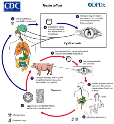 Taenia Teniasis Concise Medical Knowledge