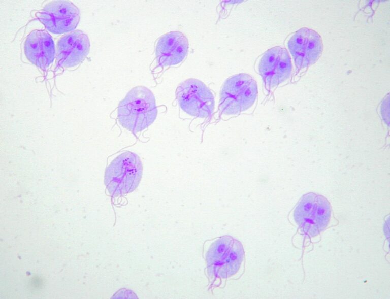 Giardia Giardiasis Concise Medical Knowledge