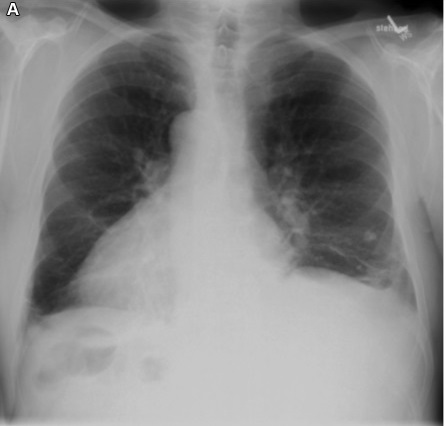 59523 internal medicine