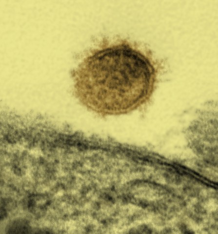Uma partícula de vírus sin nombre hantavirus bunyavirales