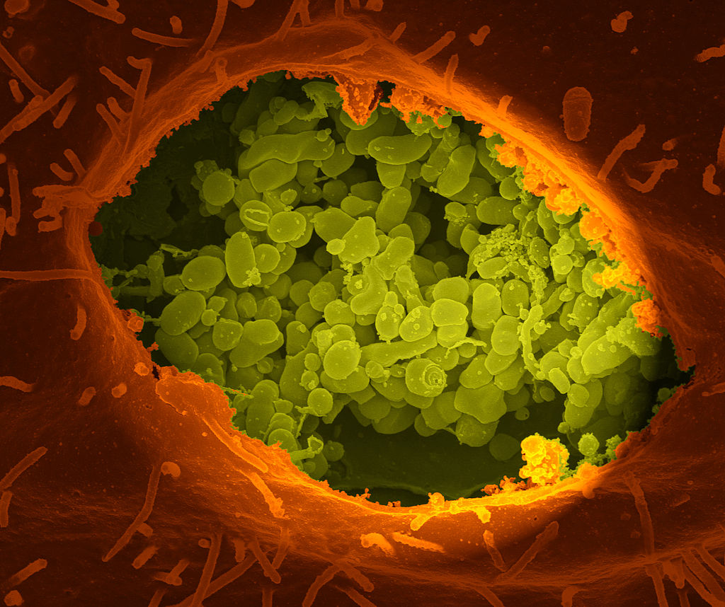 A dry fracture of a cell exposing the contents of a vacuole where coxiella burnetii (colorized in green) are growing