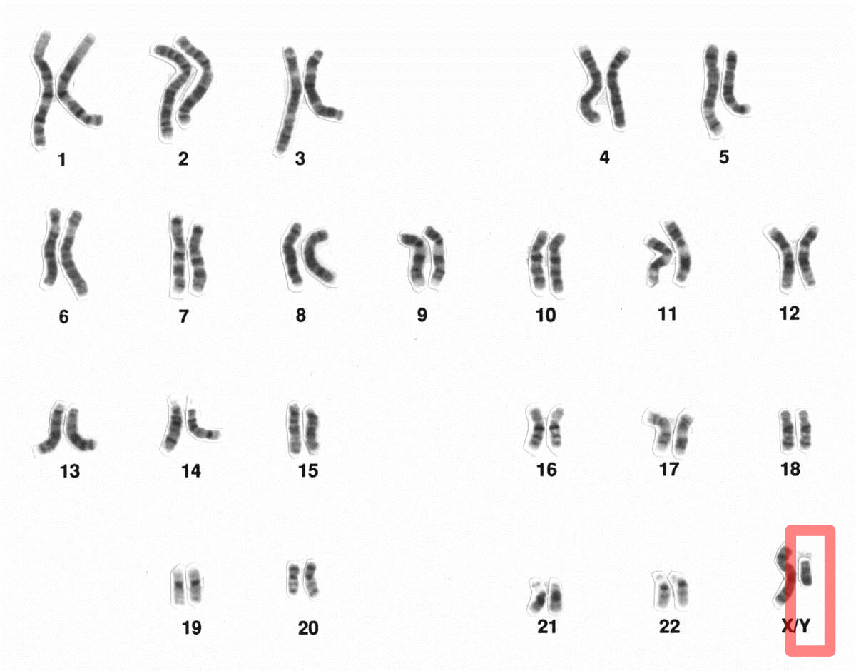 Un conjunto masculino de cromosomas.