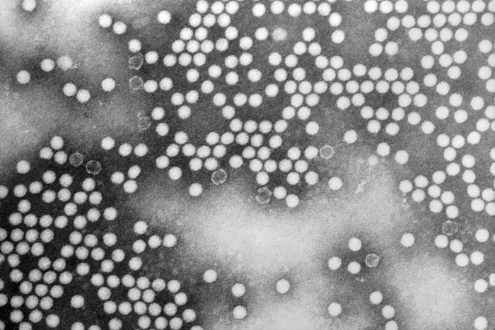 A transmission electron microscopic image poliovirus