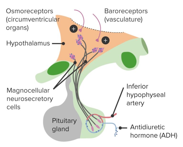Diabetes Insipidus Concise Medical Knowledge