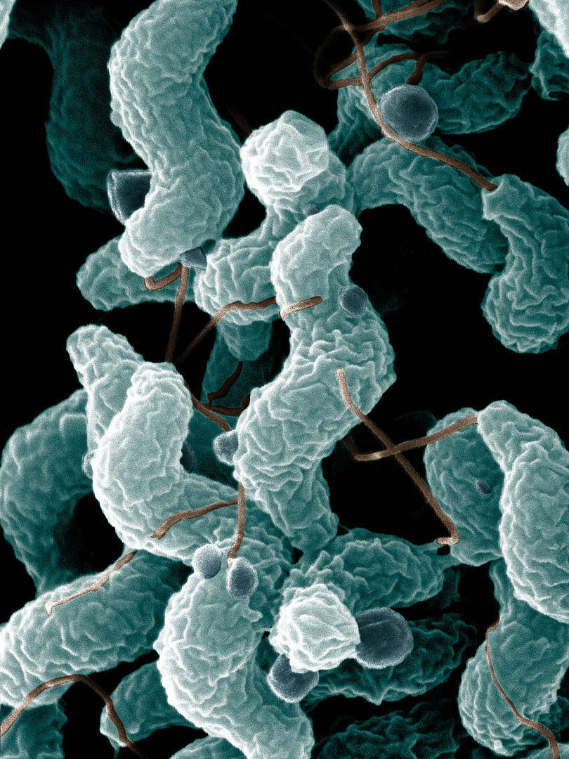 Ars campylobacter jejuni