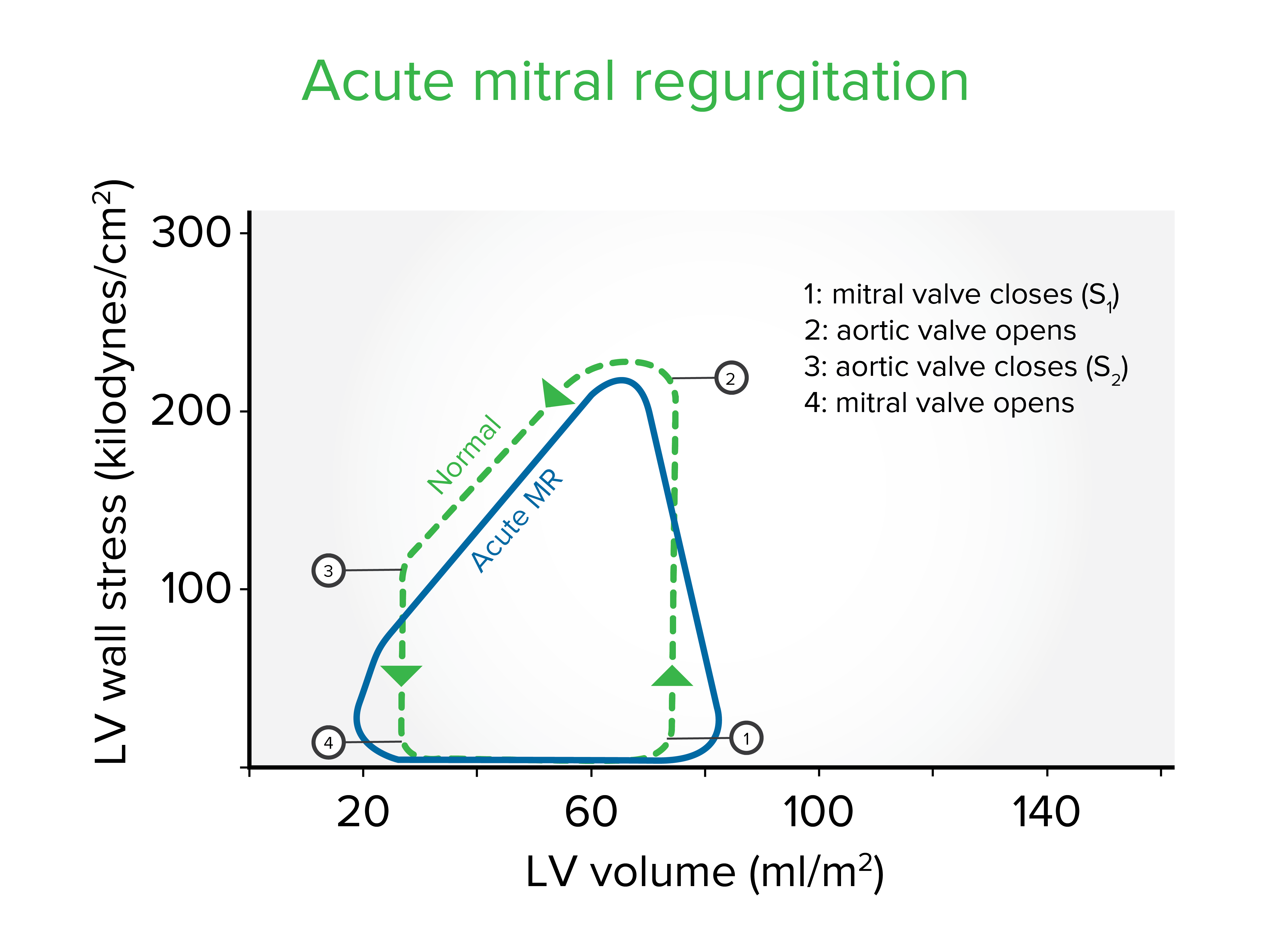Acute mitral regurgitation