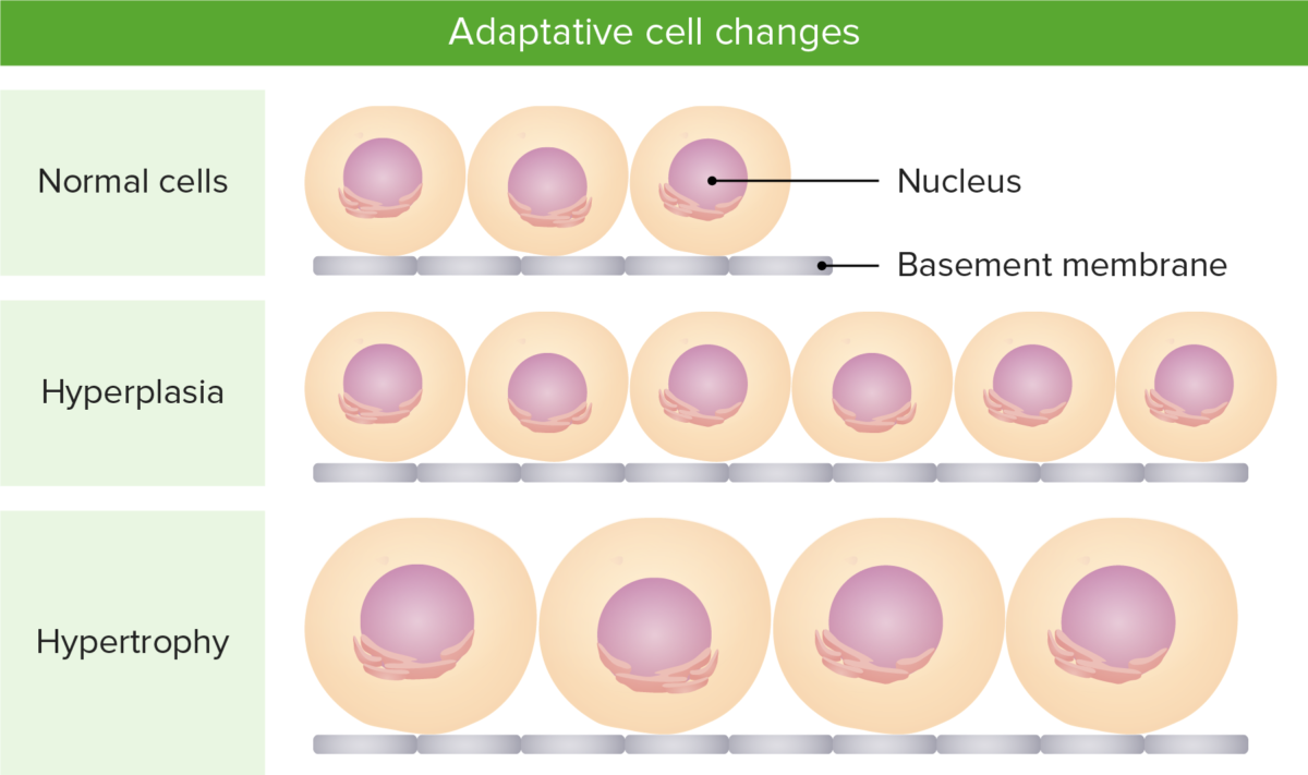 Cellular Adaptation | Concise Medical Knowledge