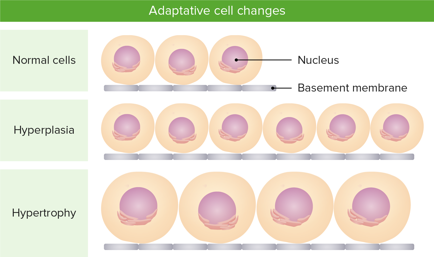 cell atrophy