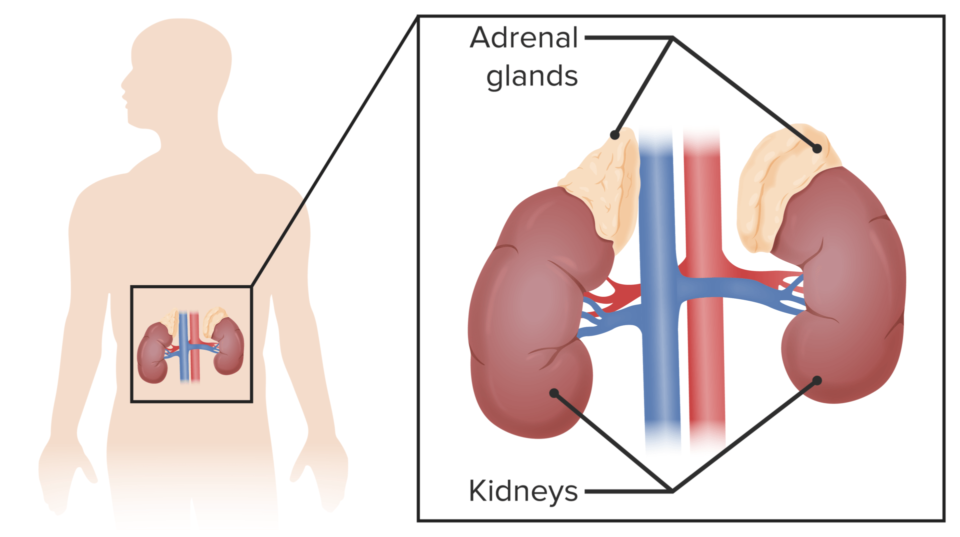Adrenal Insufficiency and Addison Disease (Clinical) | Concise Medical ...