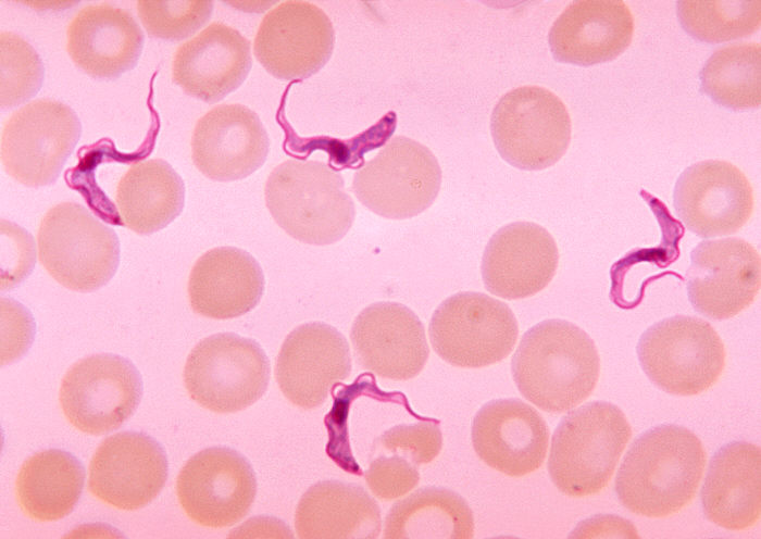 African trypanosomiasis