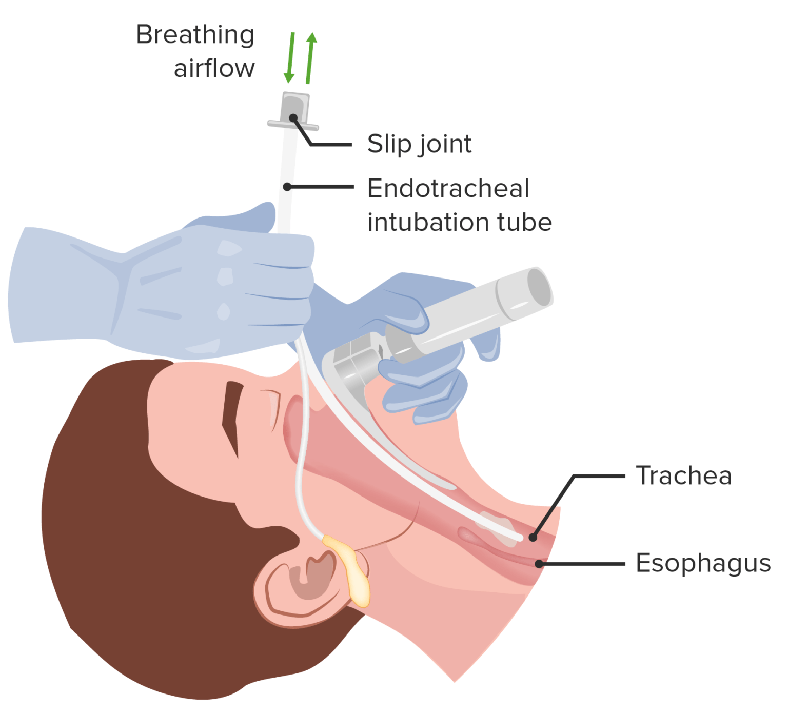 Multitrauma | Concise Medical Knowledge