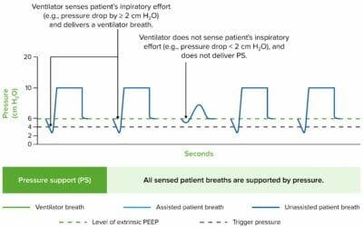 Invasive Mechanical Ventilation | Concise Medical Knowledge