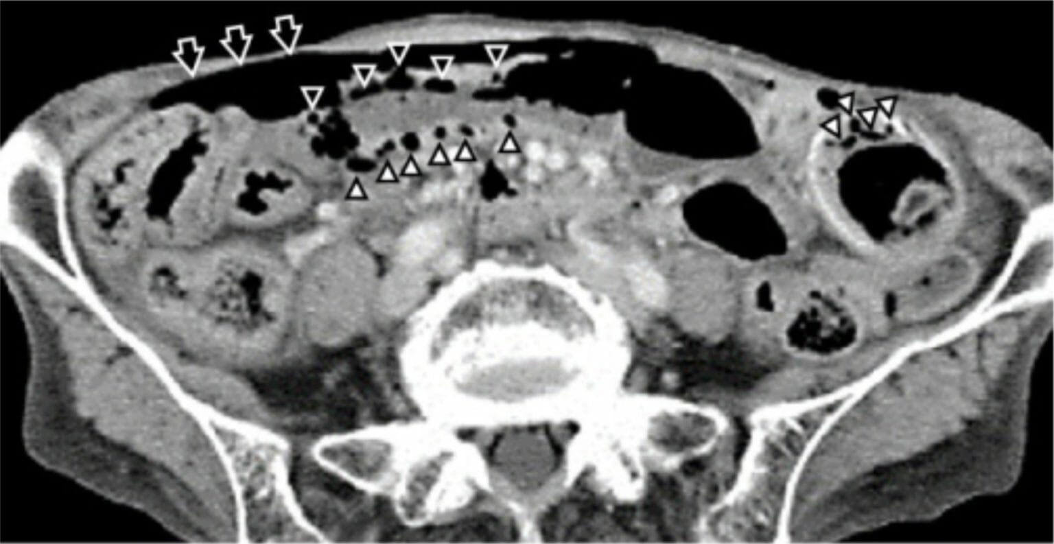 Imaging Of The Intestines Concise Medical Knowledge