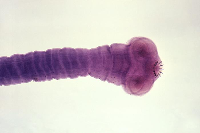 An image of the adult taenia solium tapeworm’s scolex