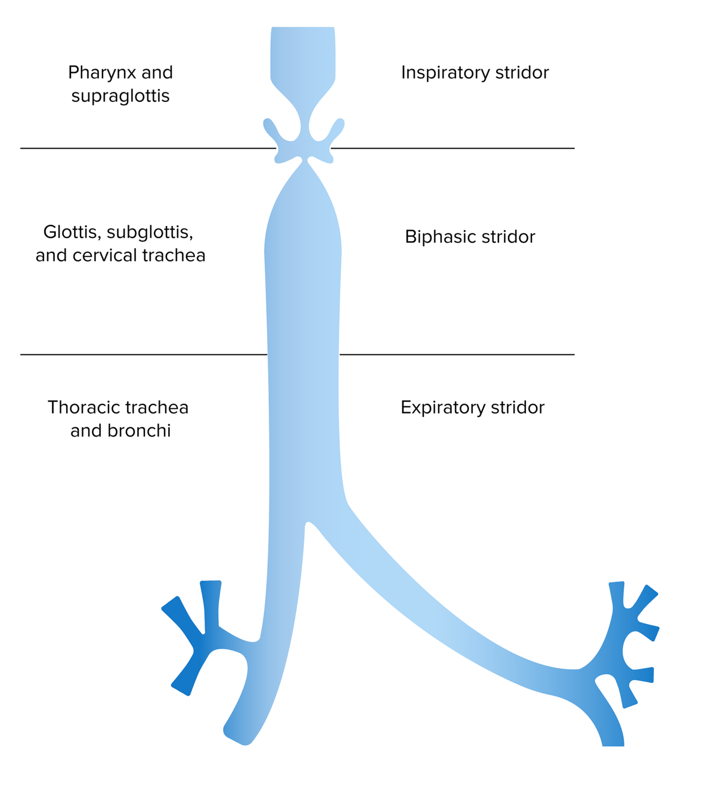 Laryngomalacia and Tracheomalacia Concise Medical Knowledge