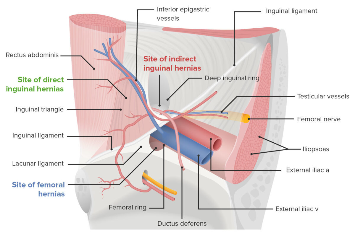 Anatomy of the inguinal region and hernia
