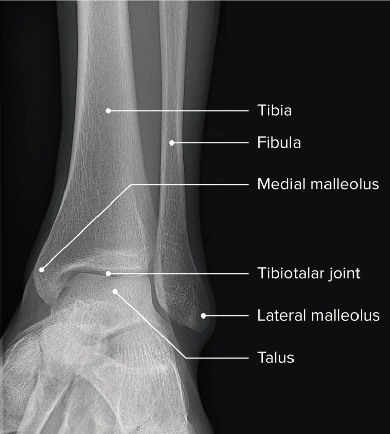 Ankle Joint: Anatomy | Concise Medical Knowledge