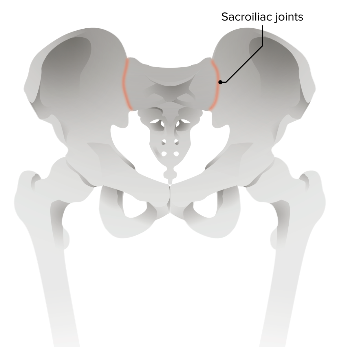 Espondilitis anquilosante