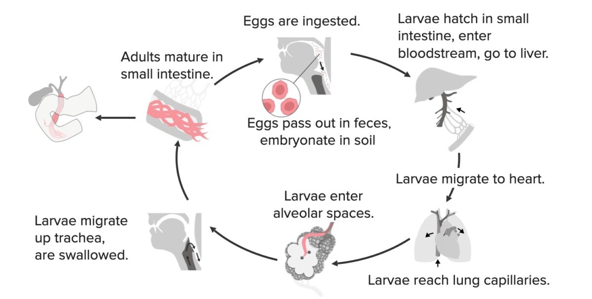 Ascaris-lifecycle diagram