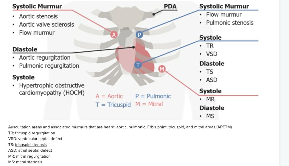 Auscultation areas