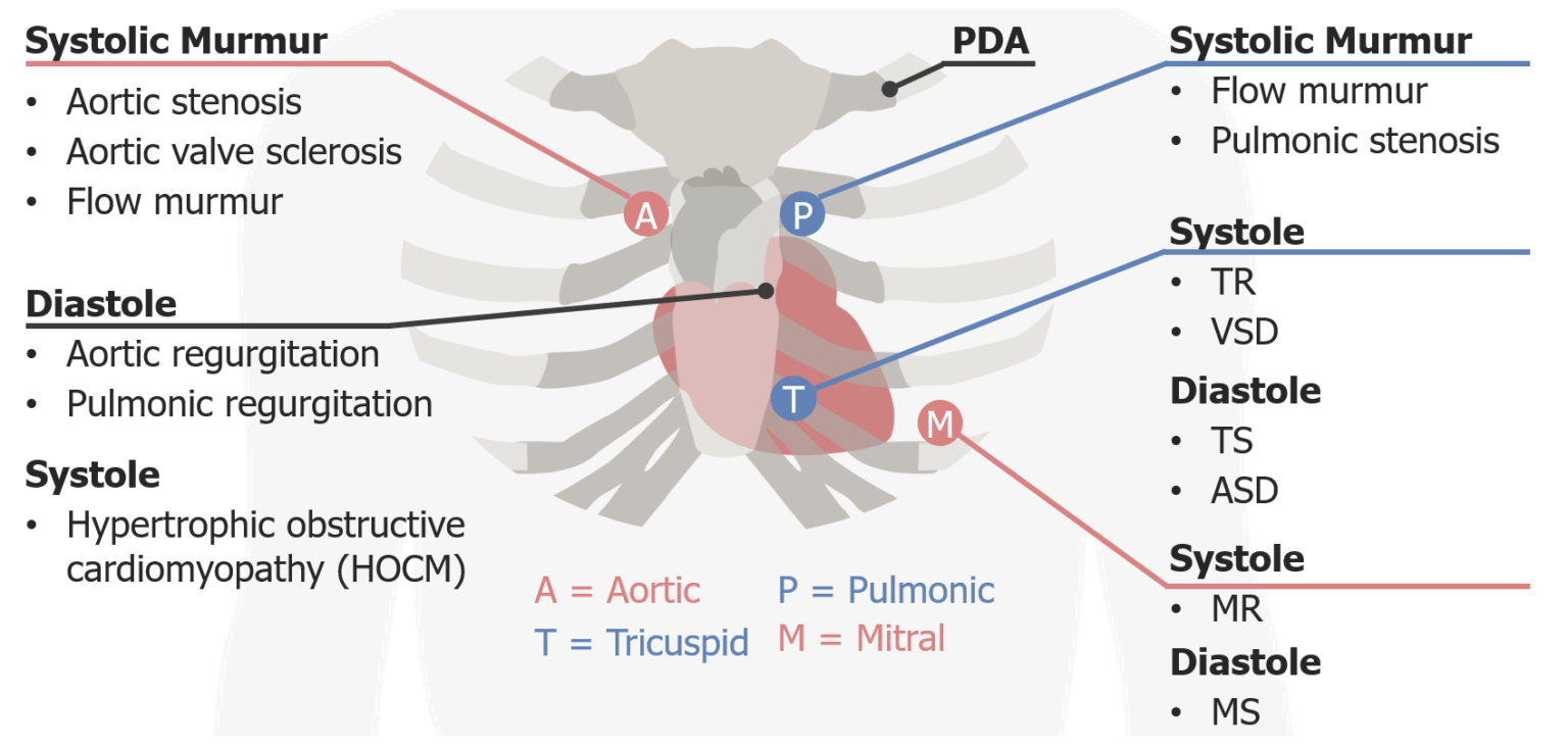 Heart Sounds | Concise Medical Knowledge