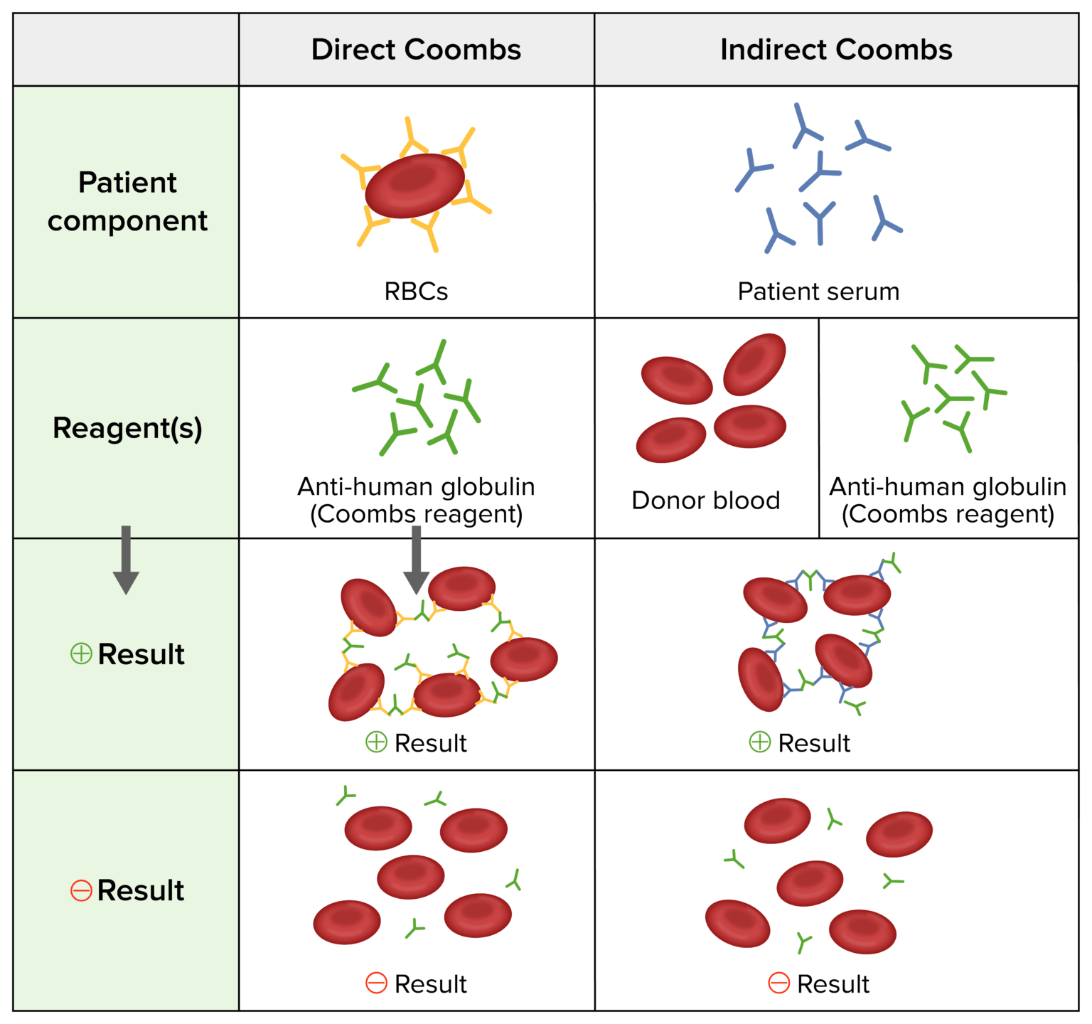 Anemia Hemolítica Autoinmune | Concise Medical Knowledge