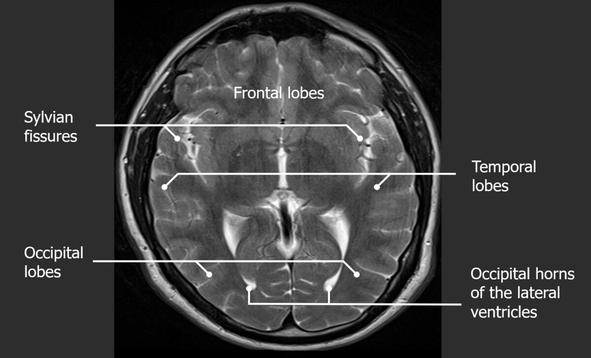 Imaging Of The Head And Brain Concise Medical Knowledge
