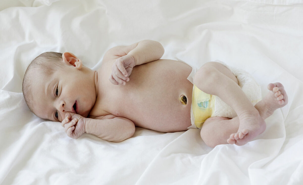 Bebé con muñón de cordón umbilical