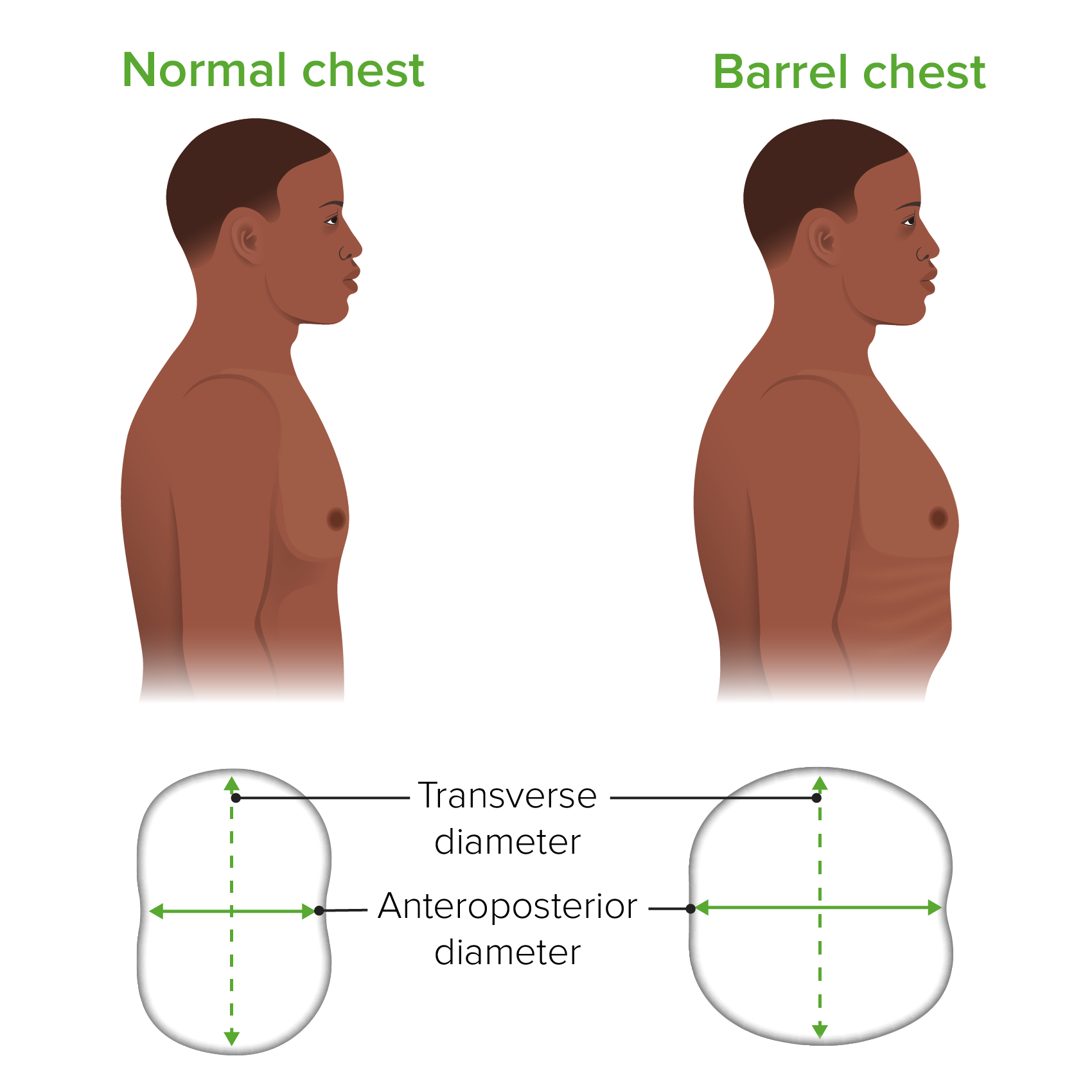 Barrel shaped chest