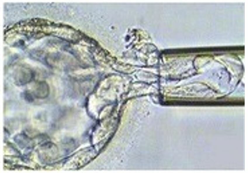 Biopsy of a blastocyst for pre-implantation genetic diagnosis