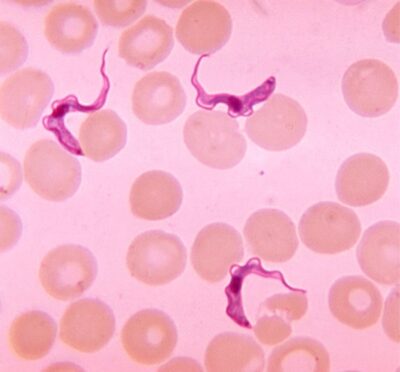 Blood smear trypanosoma chagas disease