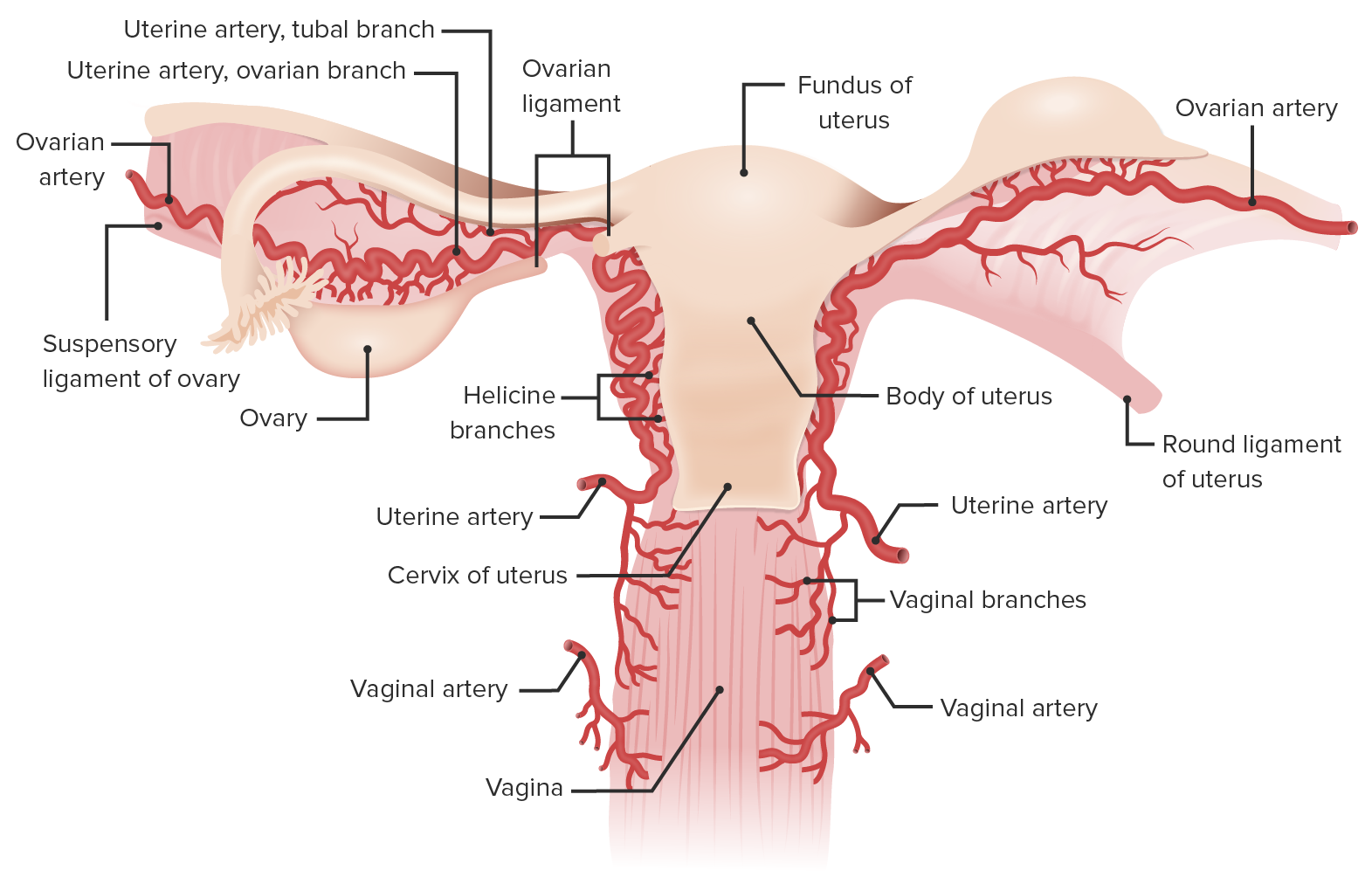 Ovarian and fallopian tube torsion - UpToDate