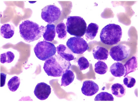 Bone marrow examination for chronic myeloid leukemia