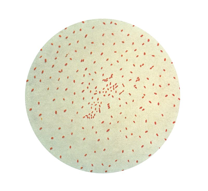 Gram stain of the bacteria bordetella pertussis