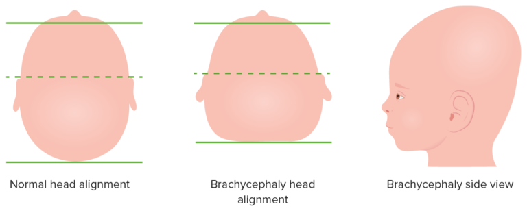 Head and Neck Examination | Concise Medical Knowledge