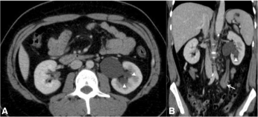Ct images of the abdomen of a 23-year-old man after intravenous contrast administration