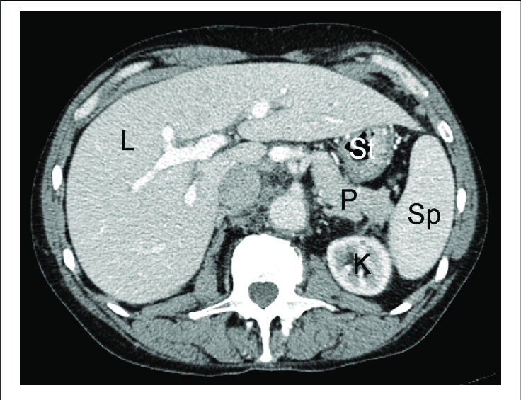 Ct scan of the liver