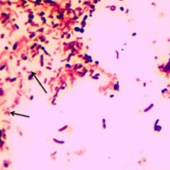 Campylobacter species