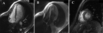 Imaging Of The Heart And Great Vessels Concise Medical Knowledge