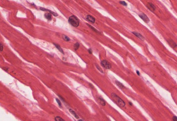 Cardiac muscle tissue demonstrating interwoven, whorled appearance