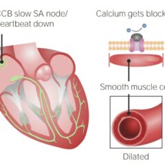 Cardiovascular effects of calcium channel blockers (CCB)