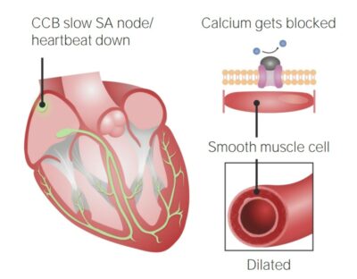 Cardiovascular effects of calcium channel blockers (ccb)