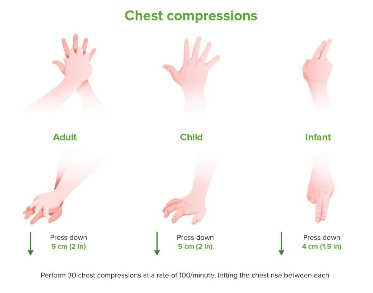 Chest compressions
