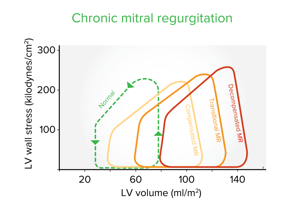 Chronic mitral regurgitation